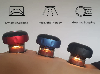 SmartCup – Terapia de Ventosas Inteligente 🔴🔥